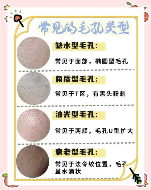 为什么毛孔越来越大