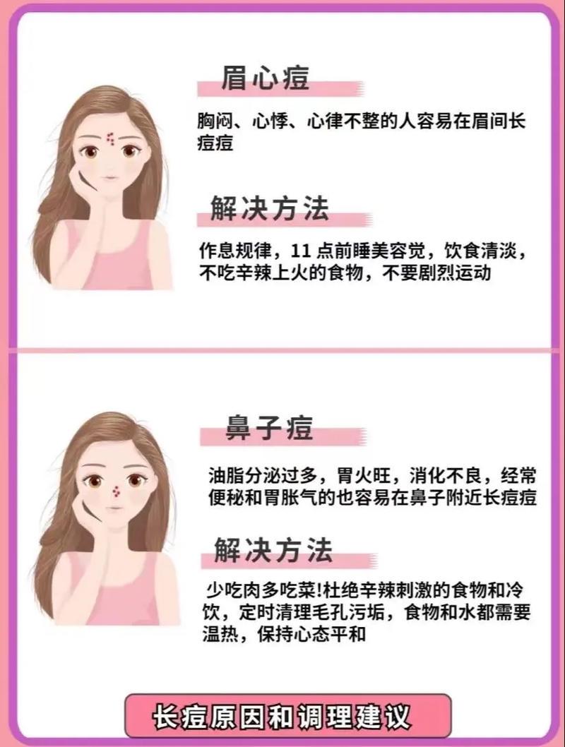 脸上频起痘?夏季护肤没做对?