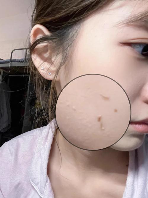 脸上角质是什么?2025年最新护肤必修课!