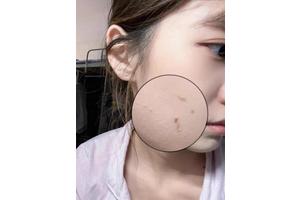 脸上角质是什么？2025年最新护肤必修课！