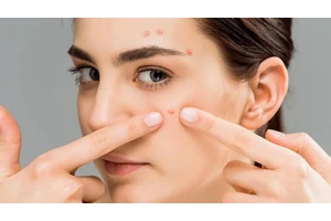 油性皮肤容易长痘怎么办？根据这五点来调理能有效改善