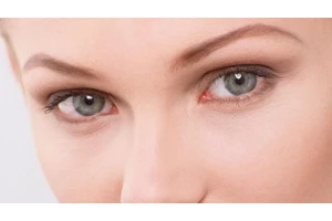 眼袋重是什么原因造成的 眼袋浮肿是什么原因