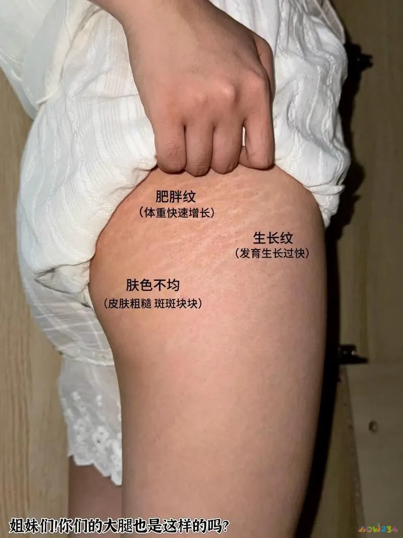 大腿脂肪消耗运动能减肥吗_怎样运动消耗大腿脂肪_大腿脂肪消耗运动能量吗