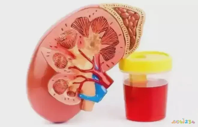 运动完增重正常吗_运动后增重会持续多久_运动后增重是什么情况