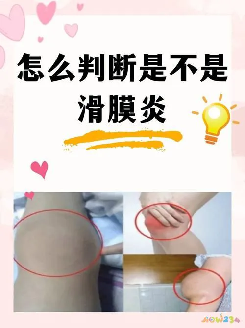 运动的膝盖疼还能运动吗_膝盖疼运动过度_运动导致的膝盖疼痛