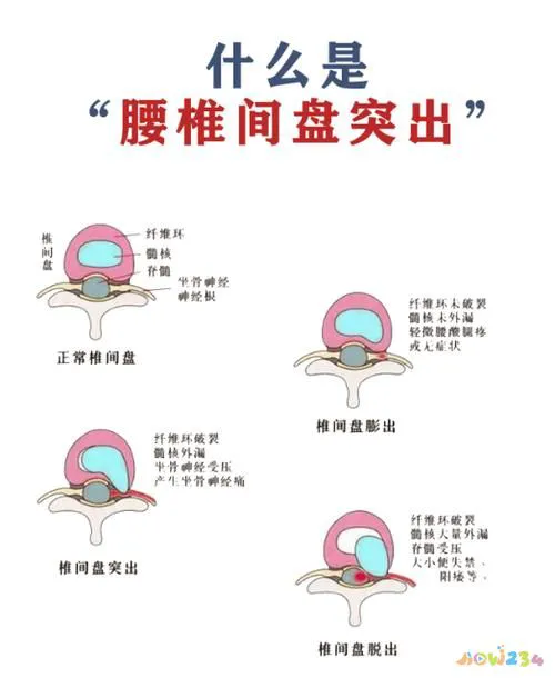 居家腰部锻炼_家里锻炼腰部方法视频_在家做什么运动对腰好