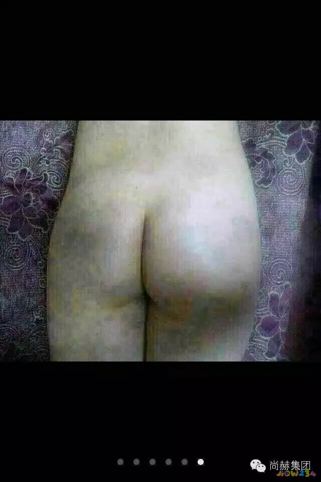 减肥的脚步_怎么运动从头脚共同减肥_脚部减肥