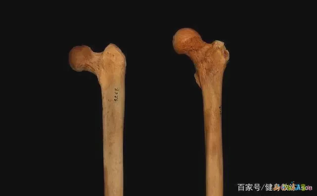 关节损伤运动深蹲髋关节疼_深蹲髋关节运动损伤_深蹲髋关节受伤