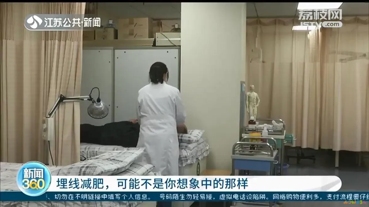 减肥做埋线会瘦吗_埋线减肥不运动胖_减肥埋线对身体有害吗