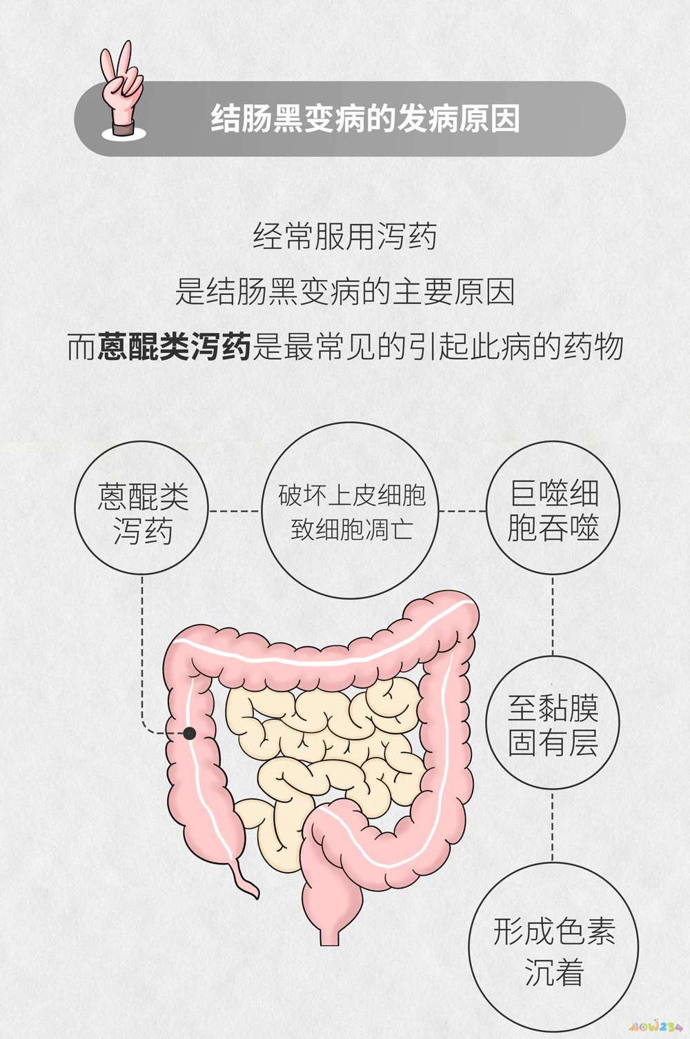 减肥药配合运动会反弹吗_减肥药配合运动好不好_减肥药配合运动效果好吗