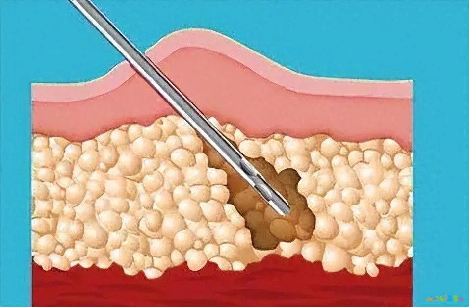 太胖运动很吃力_为什么运动感觉发胖_发胖运动感觉没力气