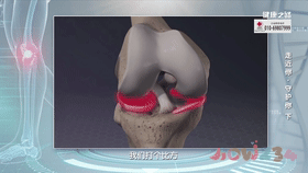 膝盖疼剧烈运动_膝盖疼痛运动导致疼痛_运动导致的膝盖疼痛