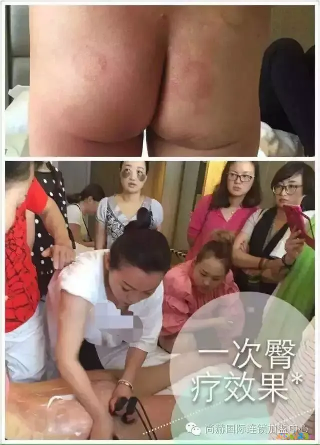 脚部减肥_怎么运动从头脚共同减肥_减肥的脚步