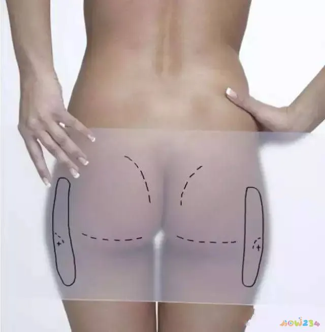 脚部减肥_减肥的脚步_怎么运动从头脚共同减肥