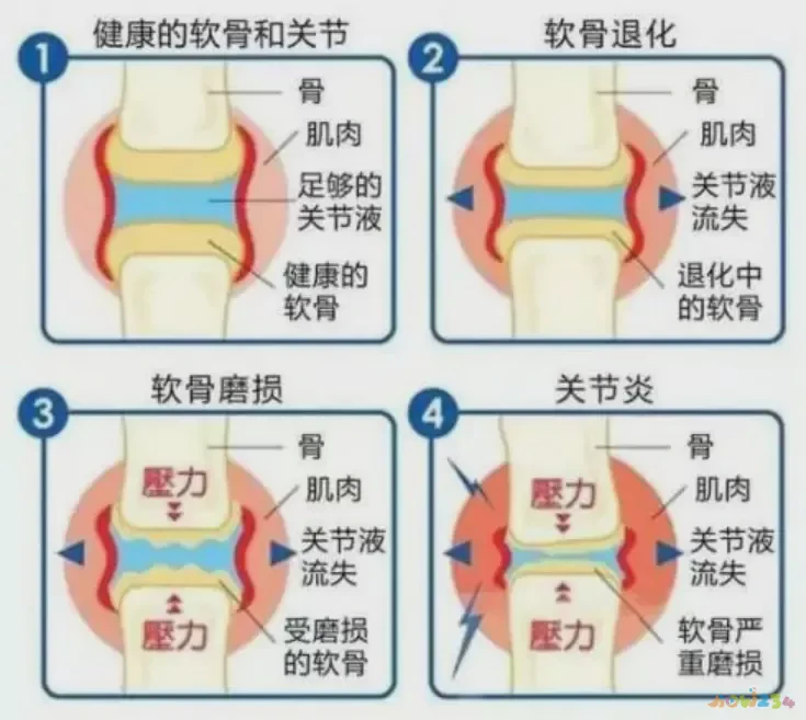 椅子抬腿法_坐椅子上做抬腿运动_坐在椅子上抬腿有什么好处