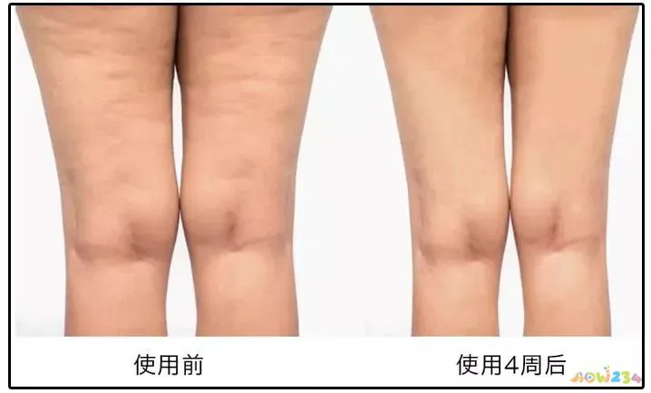 发热减肥吗_运动身体不发热有减肥效果吗_发热运动