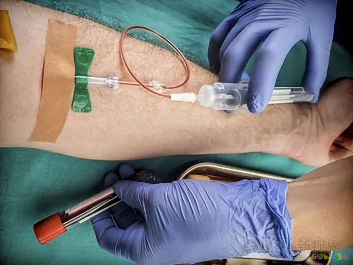 肥胖适合那些运动_肥胖体虚的人适合什么运动_强直性脊柱炎适合运动