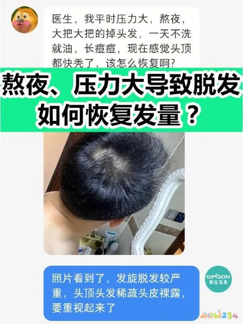 有氧运动 脱发_脱发无氧运动_脱发做有氧运动