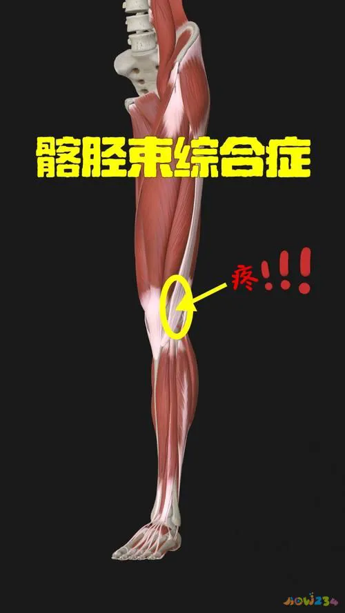 膝盖疼运动造成的疼痛_运动造成的膝盖疼_运动膝盖疼还能运动吗