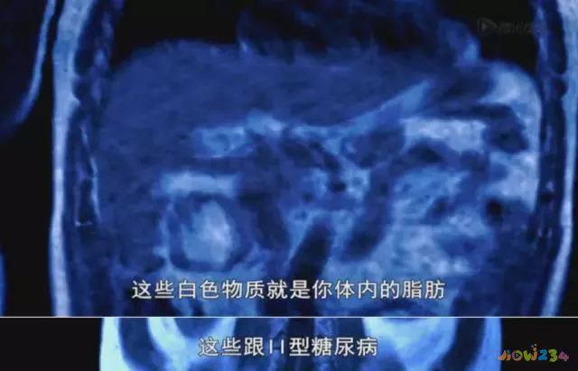 减脂期无氧运动_减脂期无氧运动多长时间_运动期减脂无氧可以吗