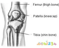 膝盖疼运动过度_运动造成的膝盖疼_膝盖疼运动造成的疼痛