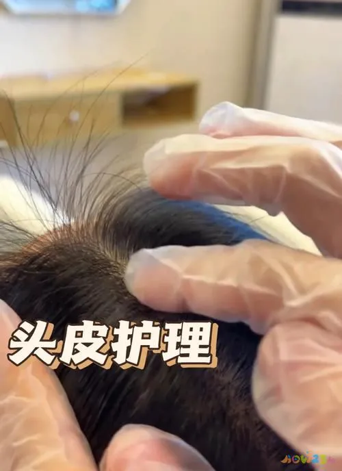 有氧运动 脱发_脱发做有氧运动_脱发无氧运动