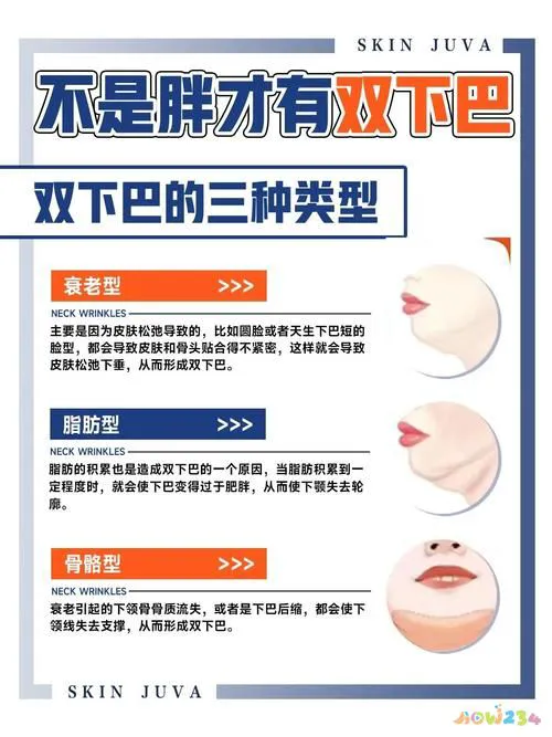 脂肪腿运动完之后需要拉伸吗_做什么运动可以消除腿部脂肪_腿部脂肪做什么运动