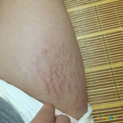 大腿脂肪消耗运动能量吗_大腿脂肪消耗运动能减肥吗_怎样运动消耗大腿脂肪