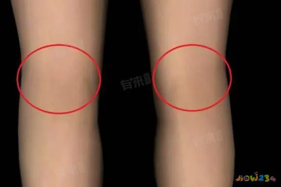 膝盖疼运动造成的疼痛_运动造成的膝盖疼_运动膝盖疼还能运动吗