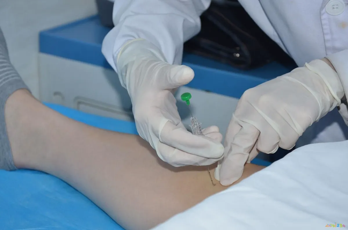 减肥埋线后可以剧烈运动吗_减肥做埋线会瘦吗_埋线减肥不运动胖