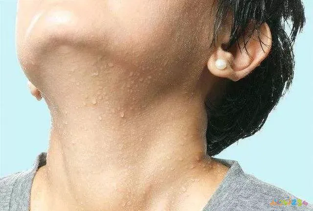 减肥夏天运动出汗好吗_夏天燃脂运动_夏天还运动减肥吗