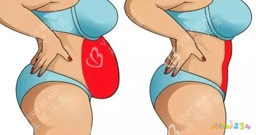 晚上做减脂运动可以变瘦么_晚上做运动减肥_晚上做运动会瘦吗