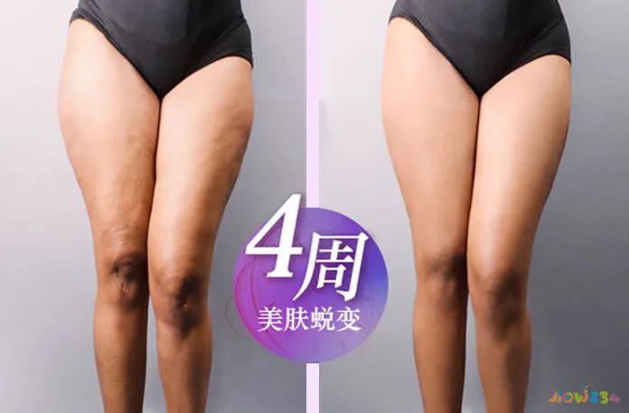 发热减肥吗_发热运动_运动身体不发热有减肥效果吗