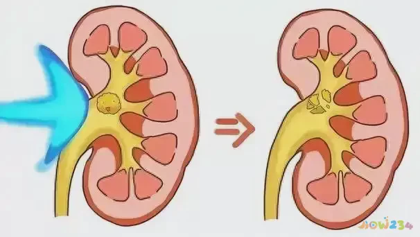 运动后增重是什么情况_运动后增重会持续多久_运动完增重正常吗