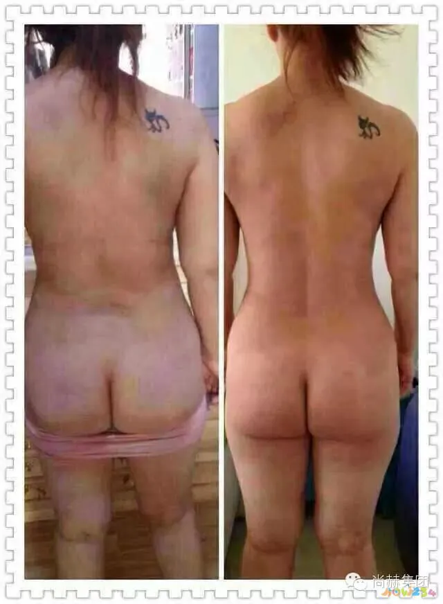 脚部减肥_减肥的脚步_怎么运动从头脚共同减肥