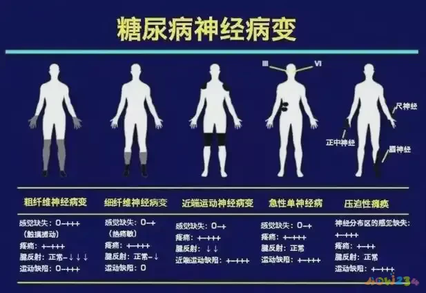 运动减肥吃几分饱_减肥运动期间吃什么好_运动减肥期间吃什么主食