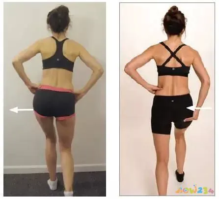 下肢运动障碍不仅要纠正，同时警惕这4大禁忌动作！避免加重损伤