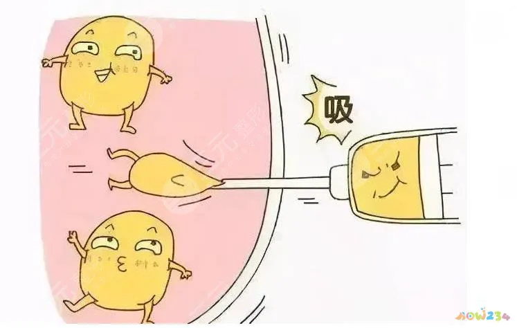 什么运动减肥果好又快不?反弹?