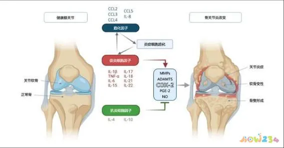 治疗剧烈运动后膝盖疼_运动后膝盖疼痛还能运动吗_膝盖剧烈运动后疼痛