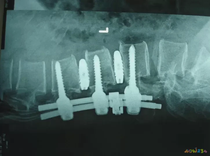 居家锻炼腰部的动作视频_在家做什么运动对腰好_家里锻炼腰部方法视频