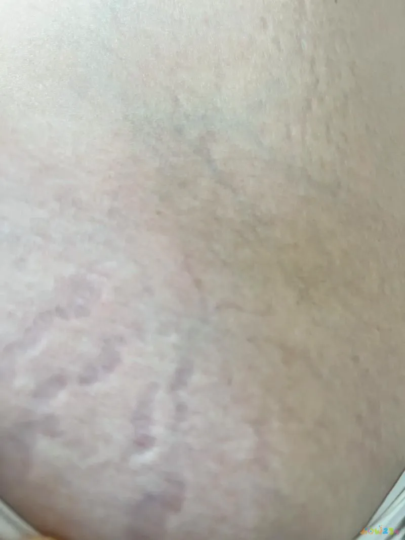 怎样运动消耗大腿脂肪_大腿脂肪消耗运动能减肥吗_大腿脂肪消耗运动能量吗