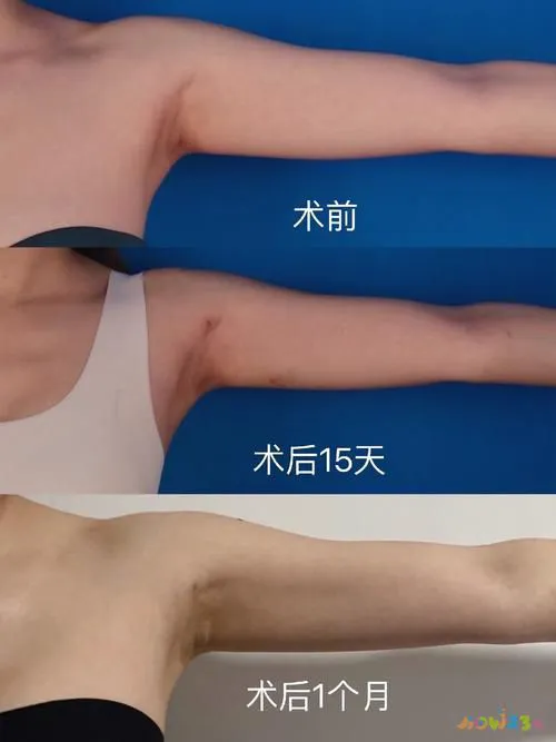 发胖运动感觉没力气_太胖运动很吃力_为什么运动感觉发胖