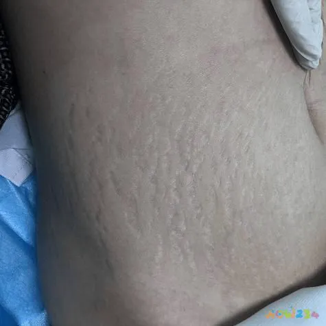 大腿脂肪消耗运动能量吗_大腿脂肪消耗运动能减肥吗_怎样运动消耗大腿脂肪