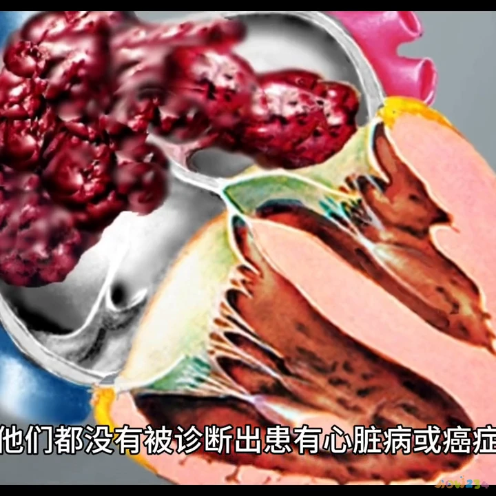 运动强度每分钟多少次_运动10分钟 5次_每次运动多少分钟适宜