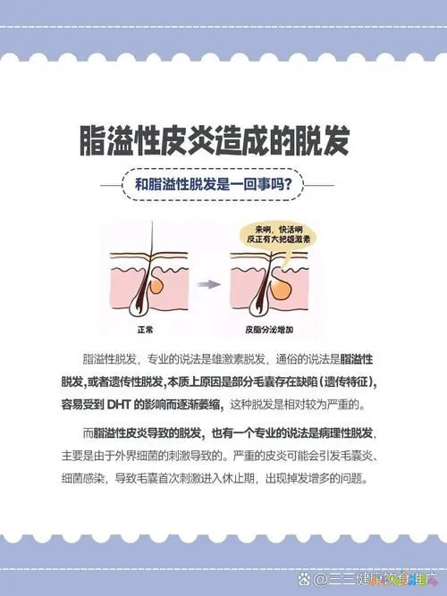 脱发做有氧运动_有氧运动 脱发_脱发运动