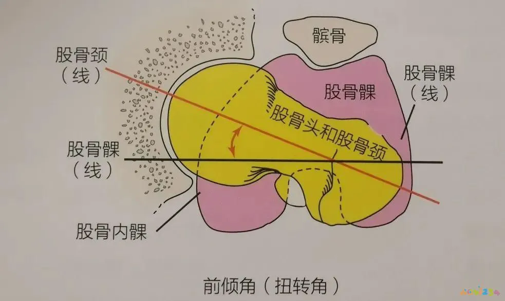 深蹲髋关节受伤_关节损伤运动深蹲髋关节疼_深蹲髋关节运动损伤