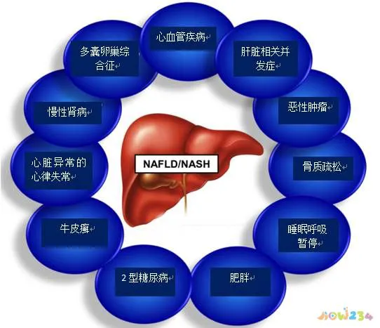 间歇有氧运动能减肥吗_间歇式有氧运动_间歇运动是有氧还是无氧