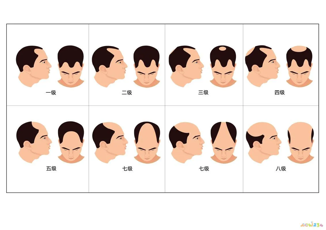 有氧运动 脱发_脱发无氧运动_脱发运动