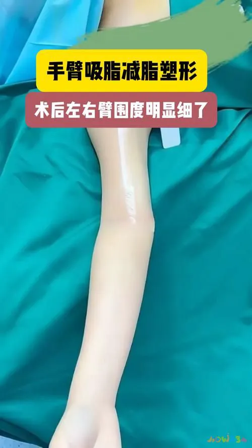 为什么运动感觉发胖_发胖运动感觉没力气_太胖运动很吃力