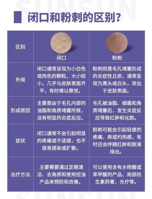 2025年粉刺爆发?熬夜/压力大/护肤错?